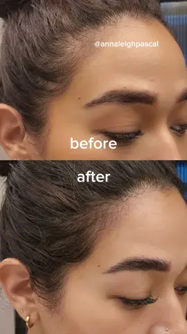 increase hair density in just 56 days with @drora.official Root Revive. if you're struggling with postpartum hair loss, thinning hair or just want to thicker more fuller hair then try this out! #drora #drorajourney #rootrevive 