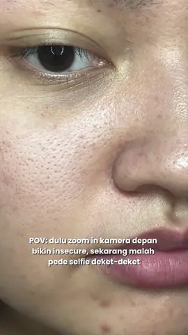 Besttt combooo kulit aku auto kinclonggg pake inii #retinol #skintific 