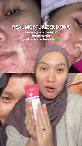 Realll penolong skinbarrier 🥰 #acnefighter #skinbarrier #laborebrandday #brandday #skinrepairexpert 