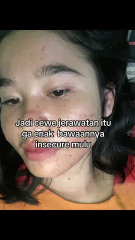 #fyp #acne #acnefighter️️ #darkspots 