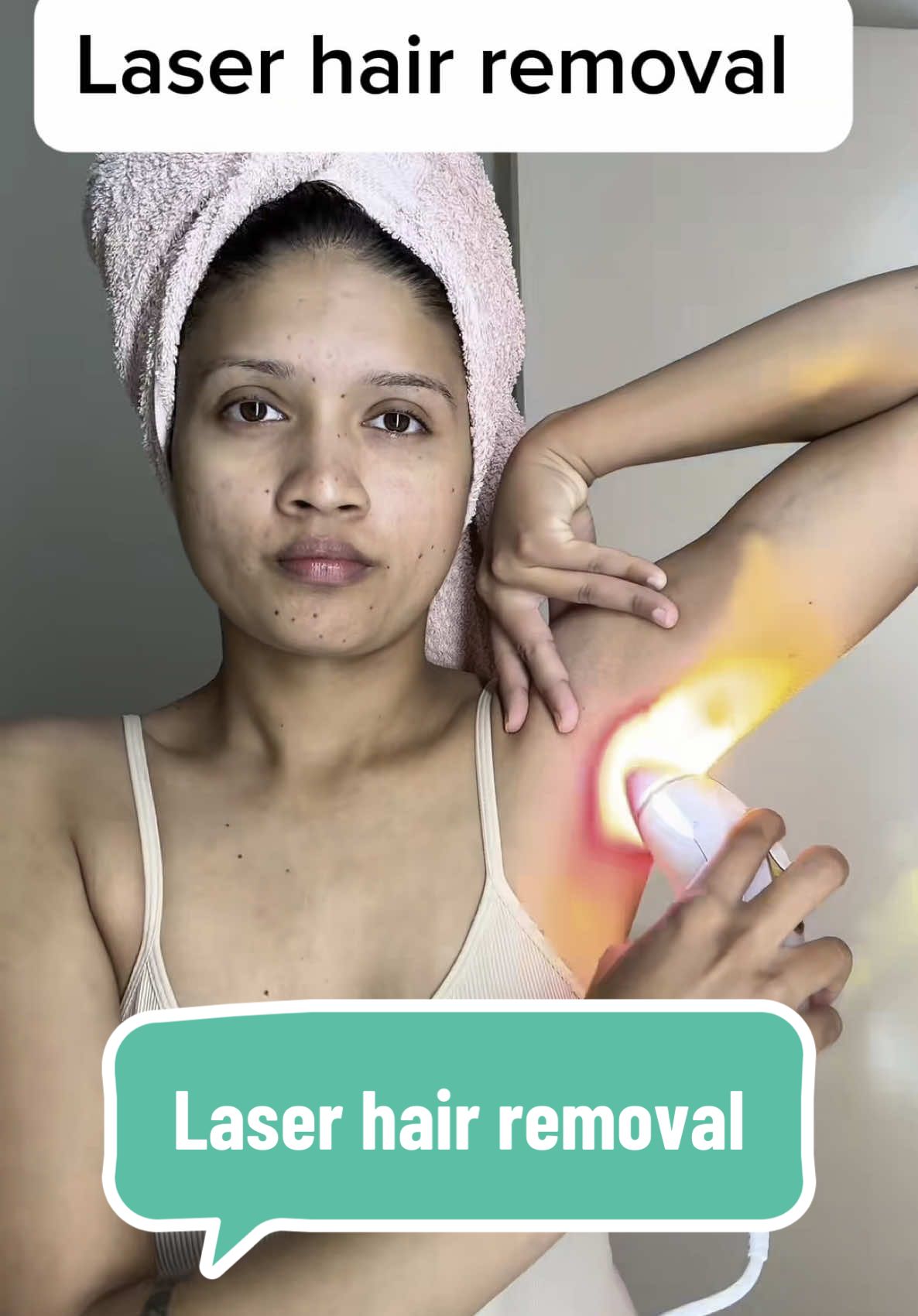 If you’ve been thinking about laser hair removal—take this as your sign. I started 5 months ago, barely stick to a schedule, and the results? Still so good. Not sponsored, just a girl who’s tired of waxing and shaving every other day. @braun_us IPL laser hair removal  #laserhairremoval #laserhair #iplhairremoval #laserhairathome #hairremoval #underarmhairremoval #ipldevice #braunpro5 #braunlaser #hairremoval 