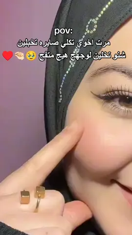 يسوي خدودج تفاح ويلمع لمع🥹🤭🤏🏻 #الفلر #مسمن #خدود #بياض #تسمين #pov #viral #tiktok 