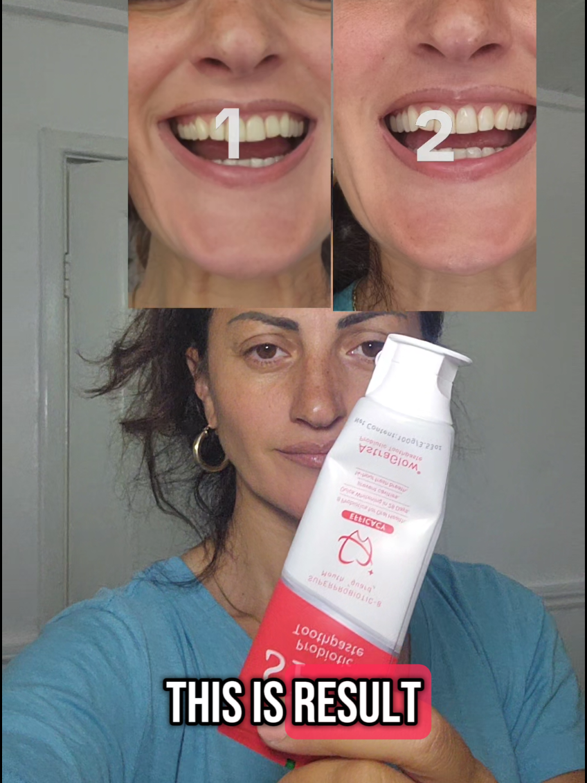 Want whiter teeth and fresh breath?I 've already started _now it's your turn!#teethwhitening #oralcareroutine #probiotictoothpaste #whitersmile #beforeandafter #freshbreth #sp8 #astraglow 