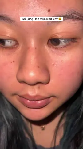 Lột xác trắng tươi 😙 #facehanako  #kemtrangda 