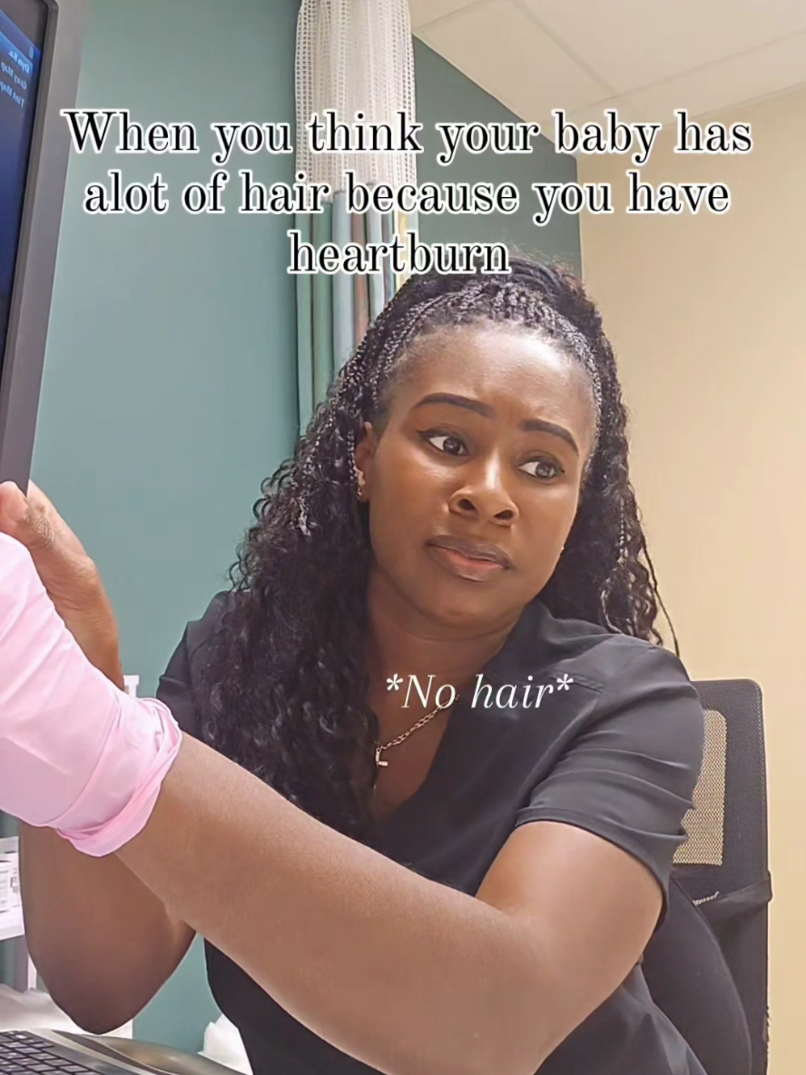 Bald head scallywag 🤭😂😂 #baldhead #nohair #baldeagle #bald #hair #alopecia #fy #viral 