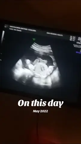 #onthisday