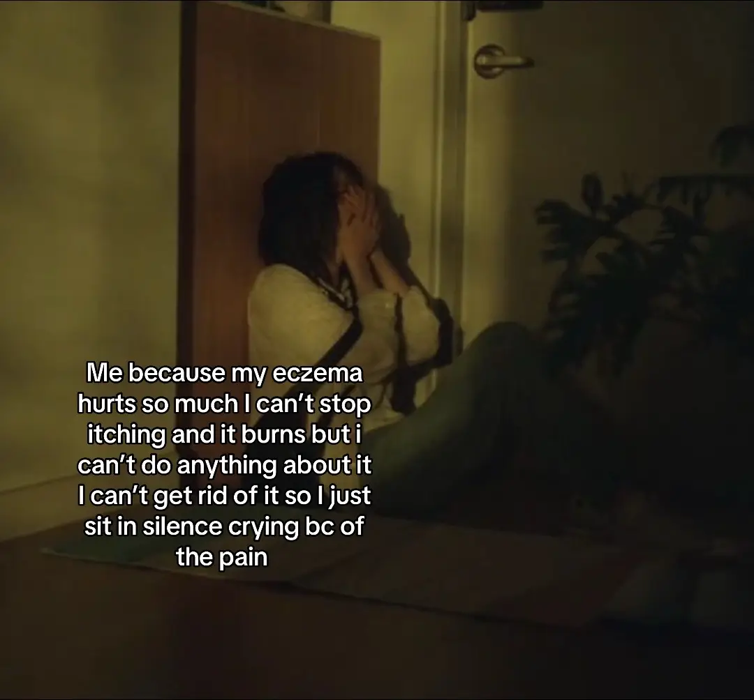 #fyp #eczema 
