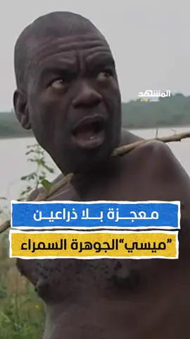 معجزة بلا ذراعين.. 