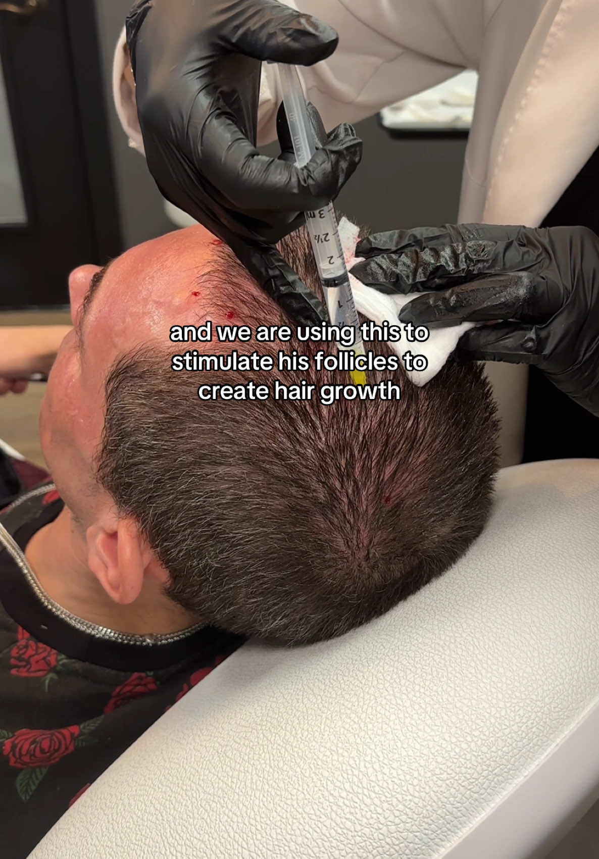 Looking to boost hair growth naturally? 💉 PRP hair restoration uses your own platelets to stimulate healthy, fuller hair, no surgery needed!  @Kennedy | Aesthetic Injector  🗓️ Love your look—Book your appointment today at LookLab.com or call 833.999.5665 (LOOK) #Botox #Filler #MedSpa #HairGrowth #PRPHairRestoration 