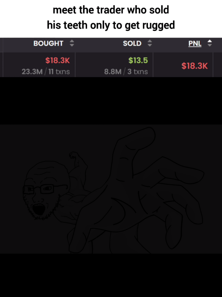 bro fr just smacked his setup 😭 (DON'T CHECK SOUND) this trader gave away his teeth just to unfortunately lose everything with trading #fyp #funnytiktok #memestiktok #cryptomemes #tradingmemes #viralvideos #😂😂😂 #memes #funny #W #teeth #gone #L 