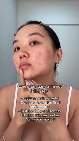 It’s either “You’re doing too much or not enough” 😀 #fyp #skintok #propaganda #acne #trend #acneproblems #clearskin #accutane #relatable 