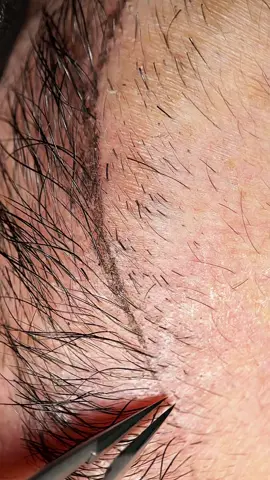 Pinça @Staleksbrasil #sobrancelhas #satisfatório #fyppppppppppppppppppppppppppppppppppp #satisfyingvideo #ordinary 