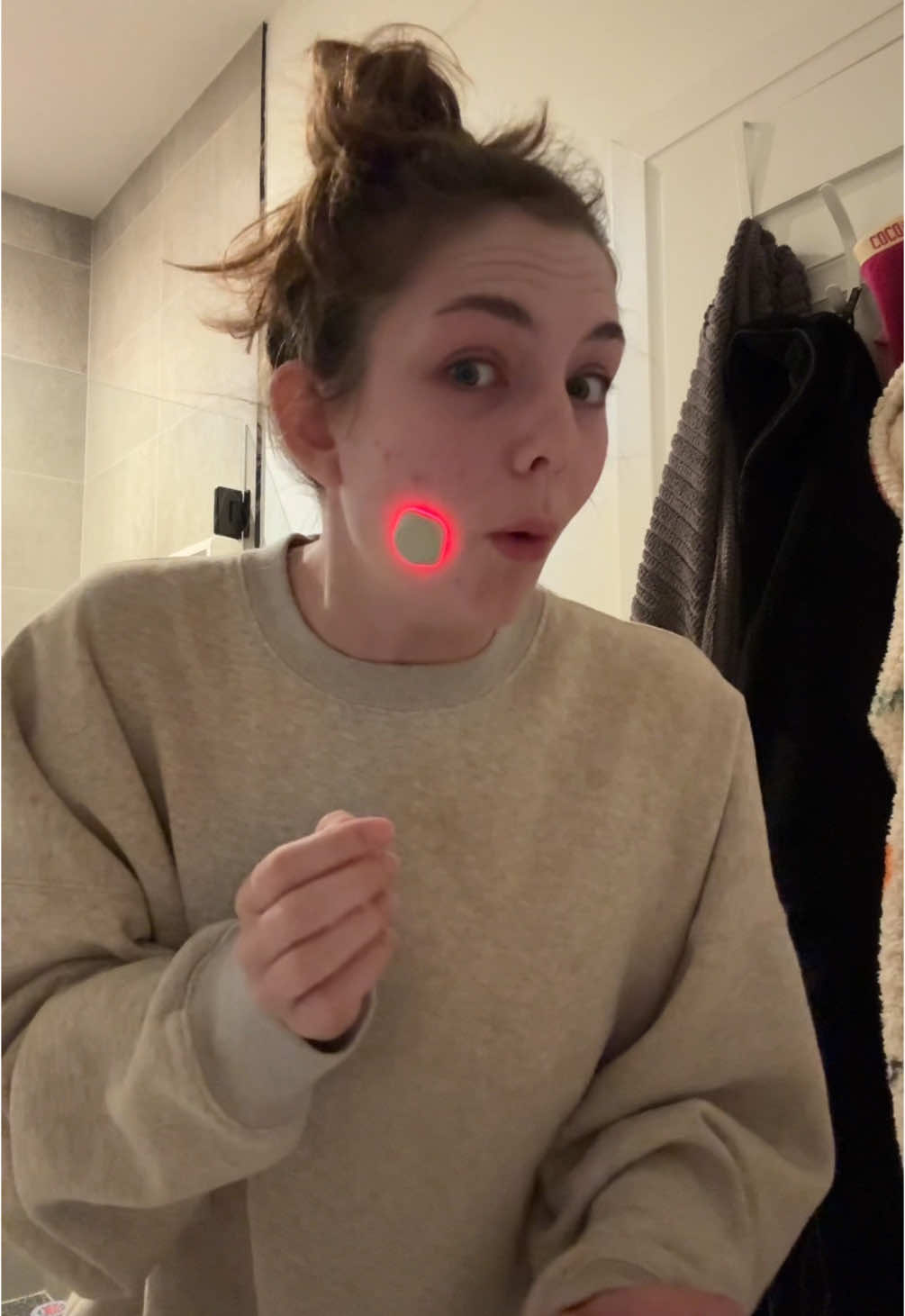 actually obsessed with the results!! it was a little bit hard to tell but the next day the pimple was soooo much better!! #fyp #pimplepatch #acneprone #acne #acneskincare #ledtherapy #acnehacks 