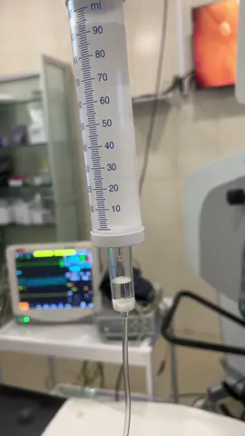 General anaesthesia #anesthesia #generalanesthesia #hospitallife #opertiontheatersound #opertiontheatervideo #operation #generalsurgery #eyesurgery #lifesaver #fyp #hospitallife🤗🤗 #foryoupage❤️❤️ #illu #viral #foruyou #forupage #generalanesthesiaproced 