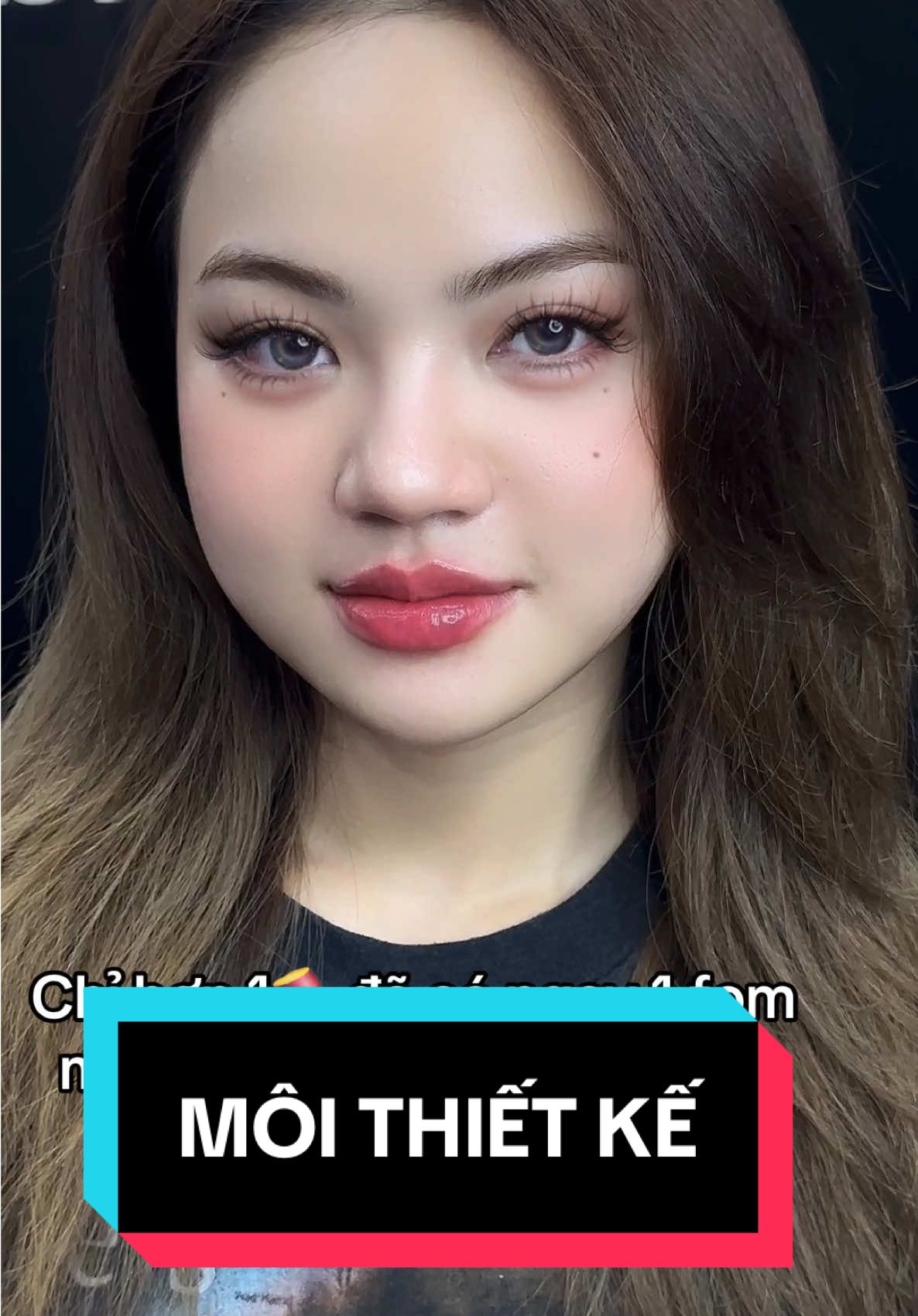 Hông làm đẹp thiệt thòi dáng chịuuuu  #filler #tiêmfiller #xuhuong #trend #xuhuongtiktok #fillerbottoxchuanykhoa #fillermoi 