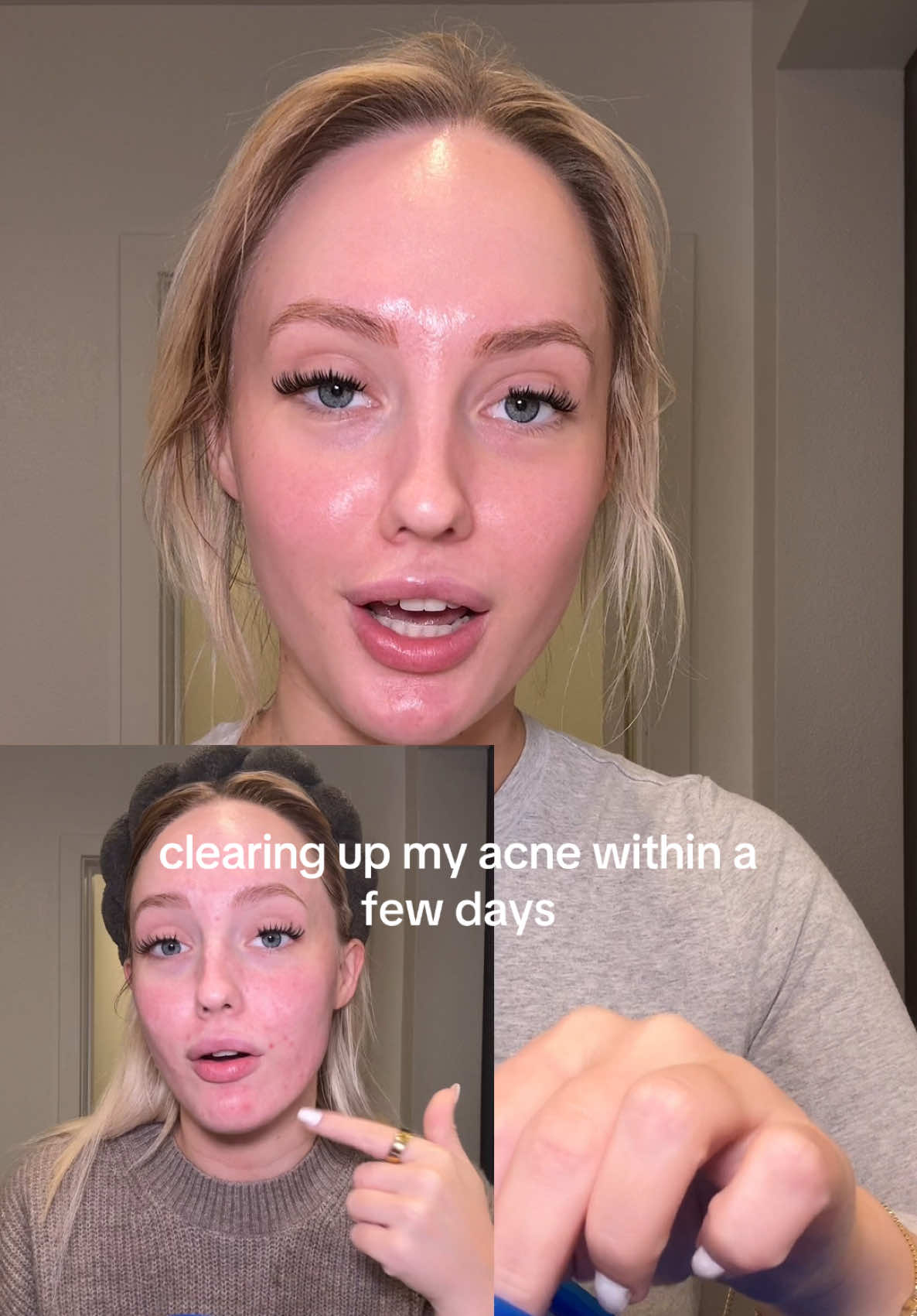 pore pads for GLASSSSS skin @medicube global #medicube #glassskin #koreanskincare #ahabha #tonerpads 