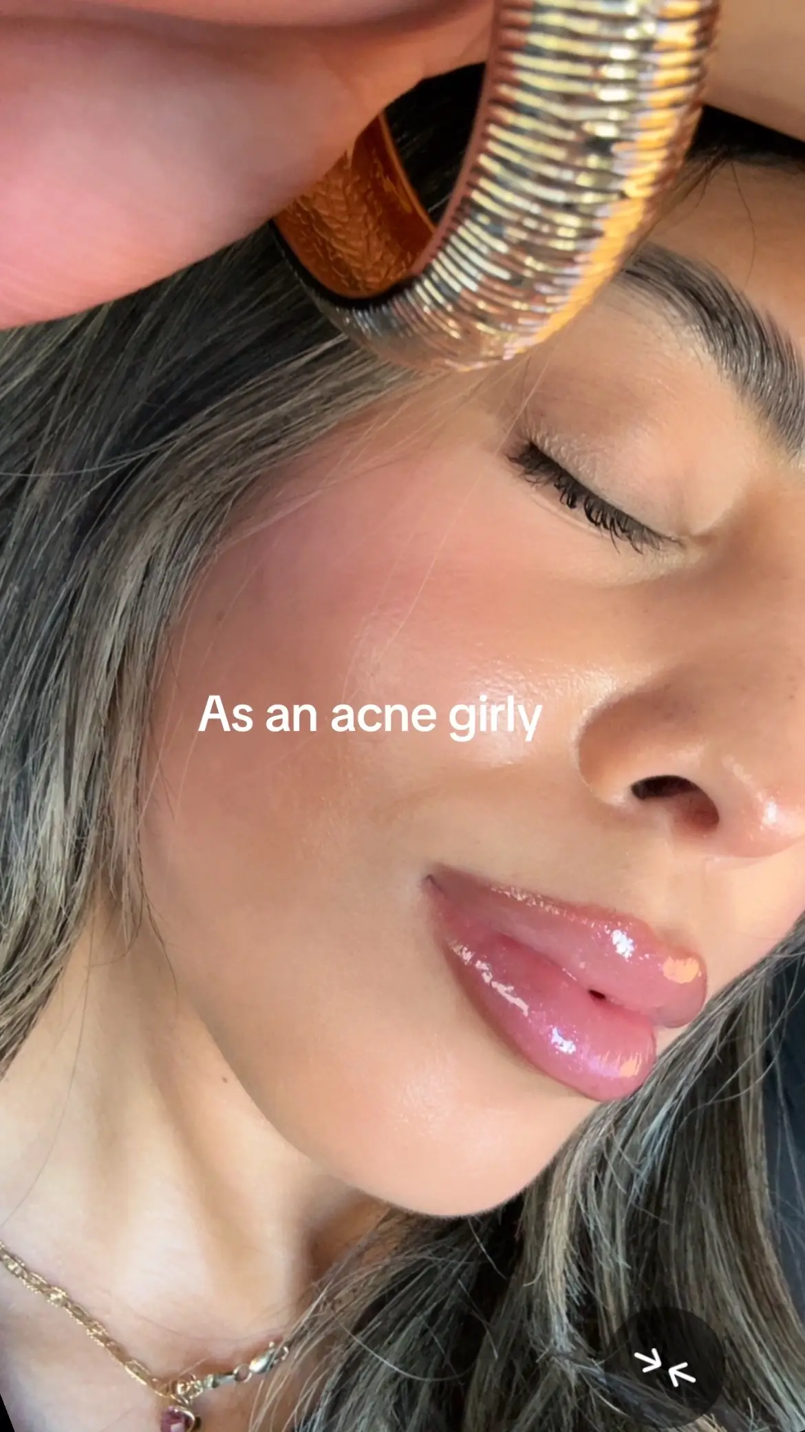 Thank you god!💗 my skin is far from perfect but after suffering from acne this is everything and more for me💗 so proud of my skin🥹 #acne#clearskin  