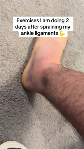 Rehabing my ankle 🩼🤕 Ankle ligaments are never a nice one. It’s sore but the worst thing you can do is do absolutely nothing otherwise you’ll get glsss ankles and it’ll heal weak. These 3 exercises I did every day during my last ankle injury on the other side and it healed very strong. They’re not too much to the point it’s agony but it’s enough to keep the ankle moving and keep some strength. If anyone has any other recommendations send them my way and I’ll try them out. #ankle #rehab #sportsinjury #injury #injuryprevention #injuryrecovery #injurycheck #footballtiktok #footballtok #for #you #page #fyp 