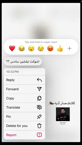 #اسكت فدوه كلامك صار اذيه #سادسيون2026  #‏ foryou#dencewithpubgmi #fypمشاهدات #عشوايات🤍 