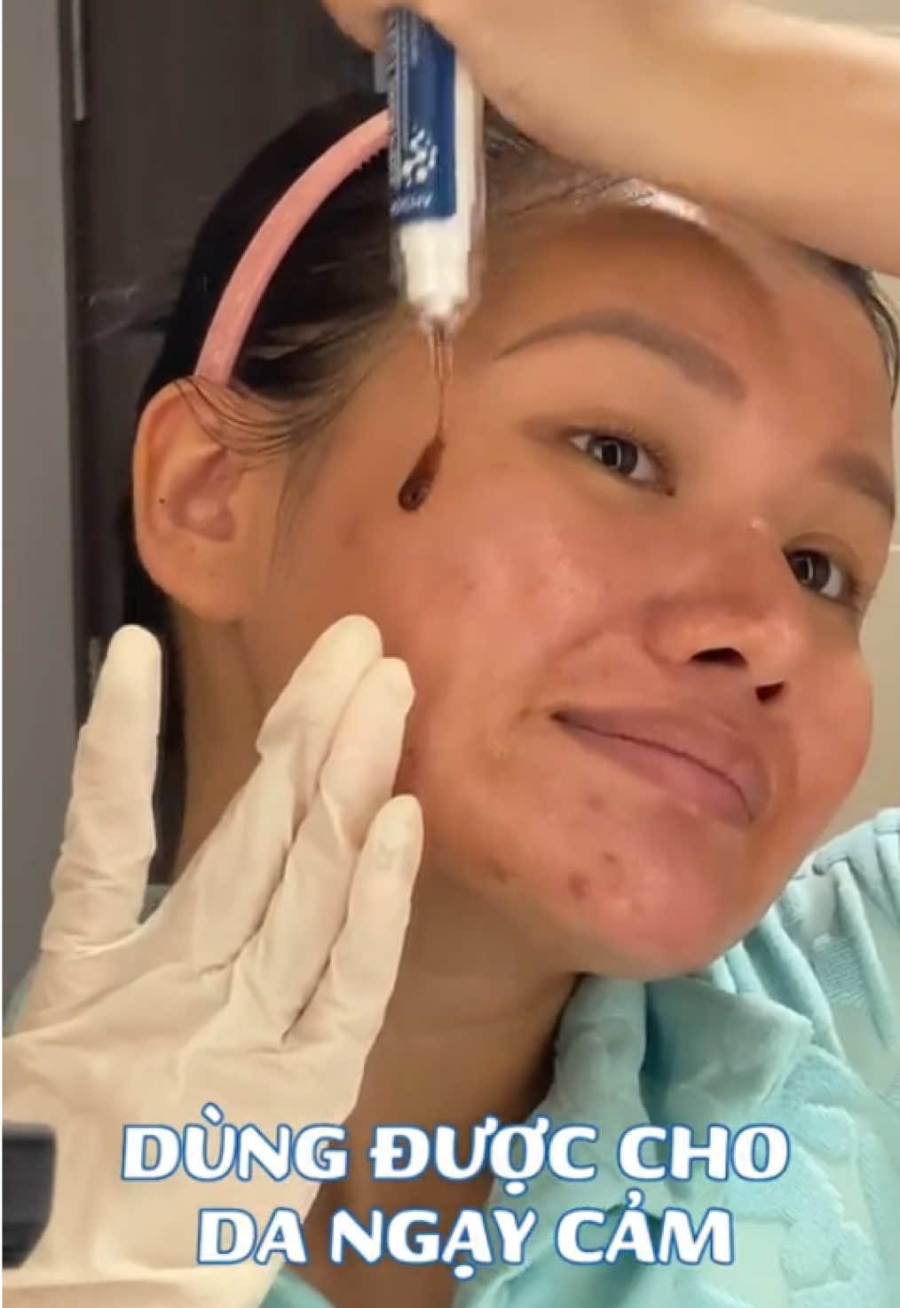 Peel xong da cứ bị đẹp lắm á mấy chị, thử ngay cho em nha #peelmocha #mochachinhhang #peelretinol #mocha 