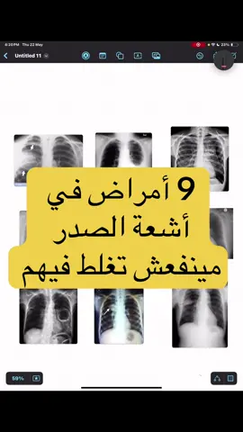 #طب #تمريض ##طلاب_طب #علاج_تنفسي 