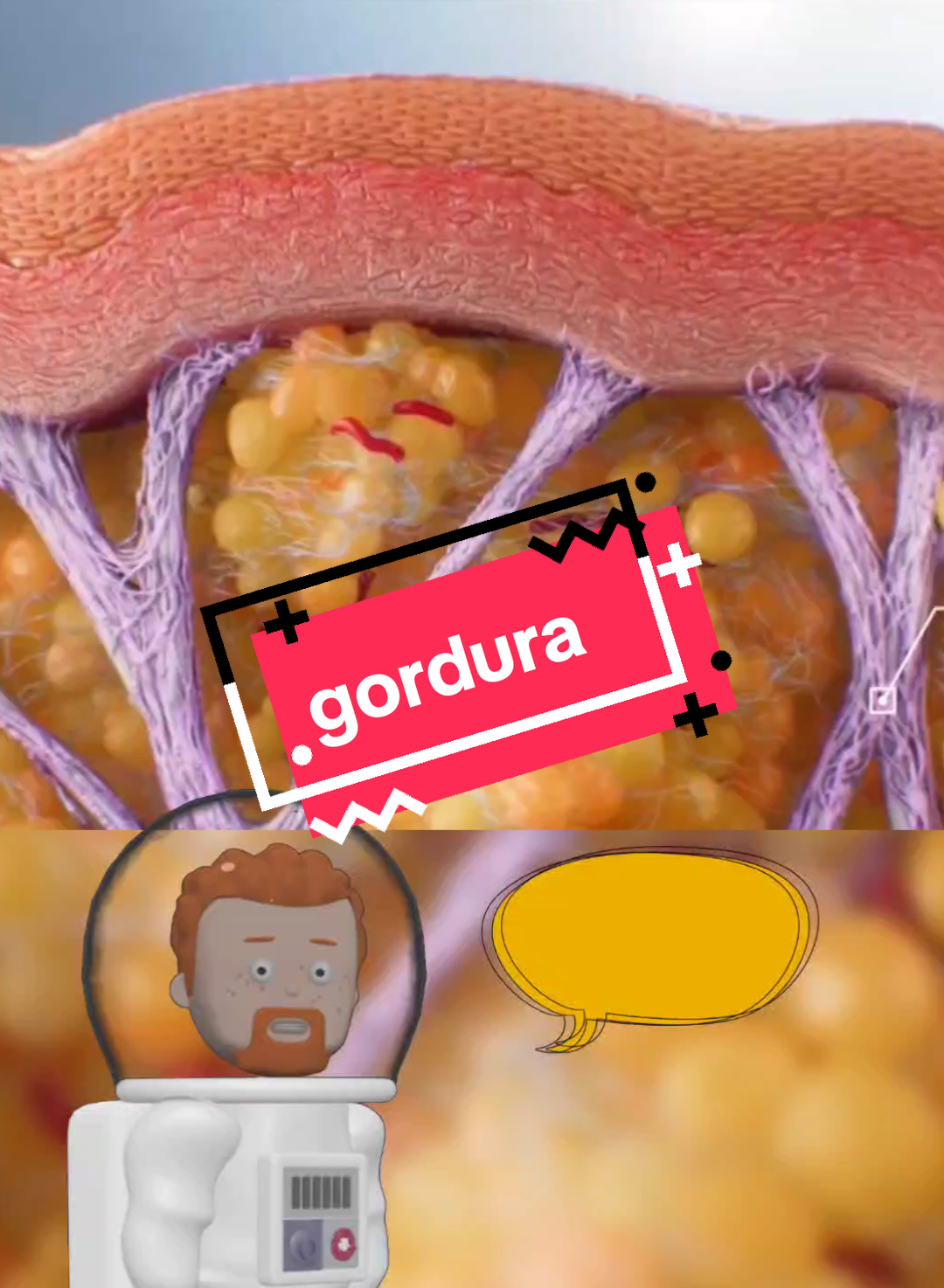 Gordura acumulada 🧽 🥐. #corpohumano #gordura #curiosidades #tiktokviral 
