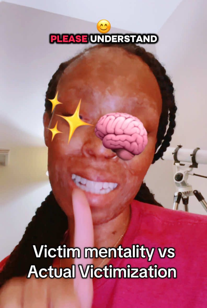 Please learn the difference and stop expecting victims to bury their pain for your comfort 🙄 