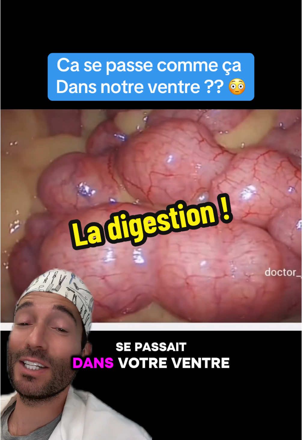 Le péristaltisme intestinal correspond aux contractions involontaires de notre tube digestif responsable des borborigmes, les fameux glougous pour faire avancer nos aliments pendant la digestion ! #intestino #colon #intestin #digestion #aliment #estomac #medecine #medical #sante #apprendresurtiktok 