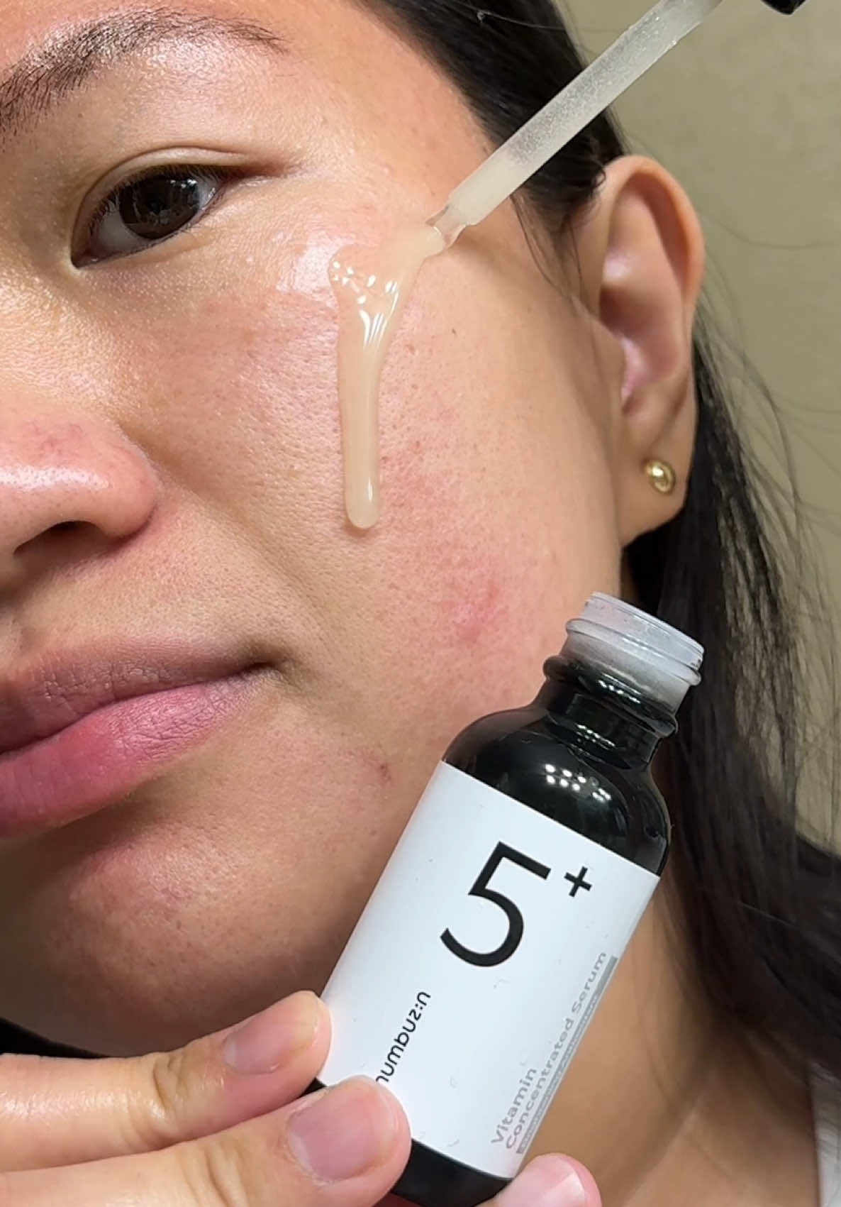 A week with numbuzin serum no.5 Not only it’s brighter dark spots also faded away. #numbuzin #numbuzinsquad #numbuzinserum #gluthatione #hyperpigmentation #vitaminc #darkspots #koreanskincare #skincare #skincareroutine @numbuzin Official @numbuzin #creatorsearchinsights #engagement 