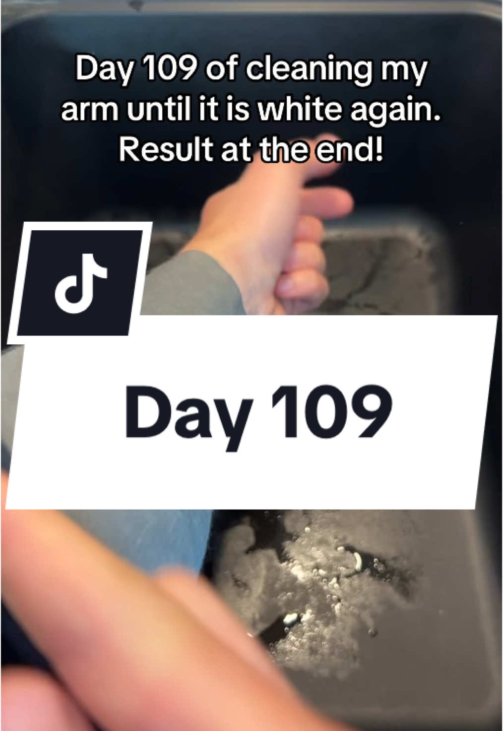 Day 109 of cleaning my arm.🪥 #day1 #cleaning #day501 