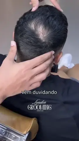 Cubra a calvice e recupere sua autoestima!