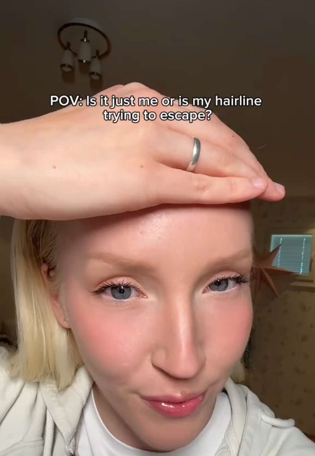 Is it just me, or is my hairline coming back to life?🔥🤩 #seapuri #fyp #seapuripartner #seapurihairampoule  #hairgrowth #thinhairline #hairserum #bigforehead #bald 