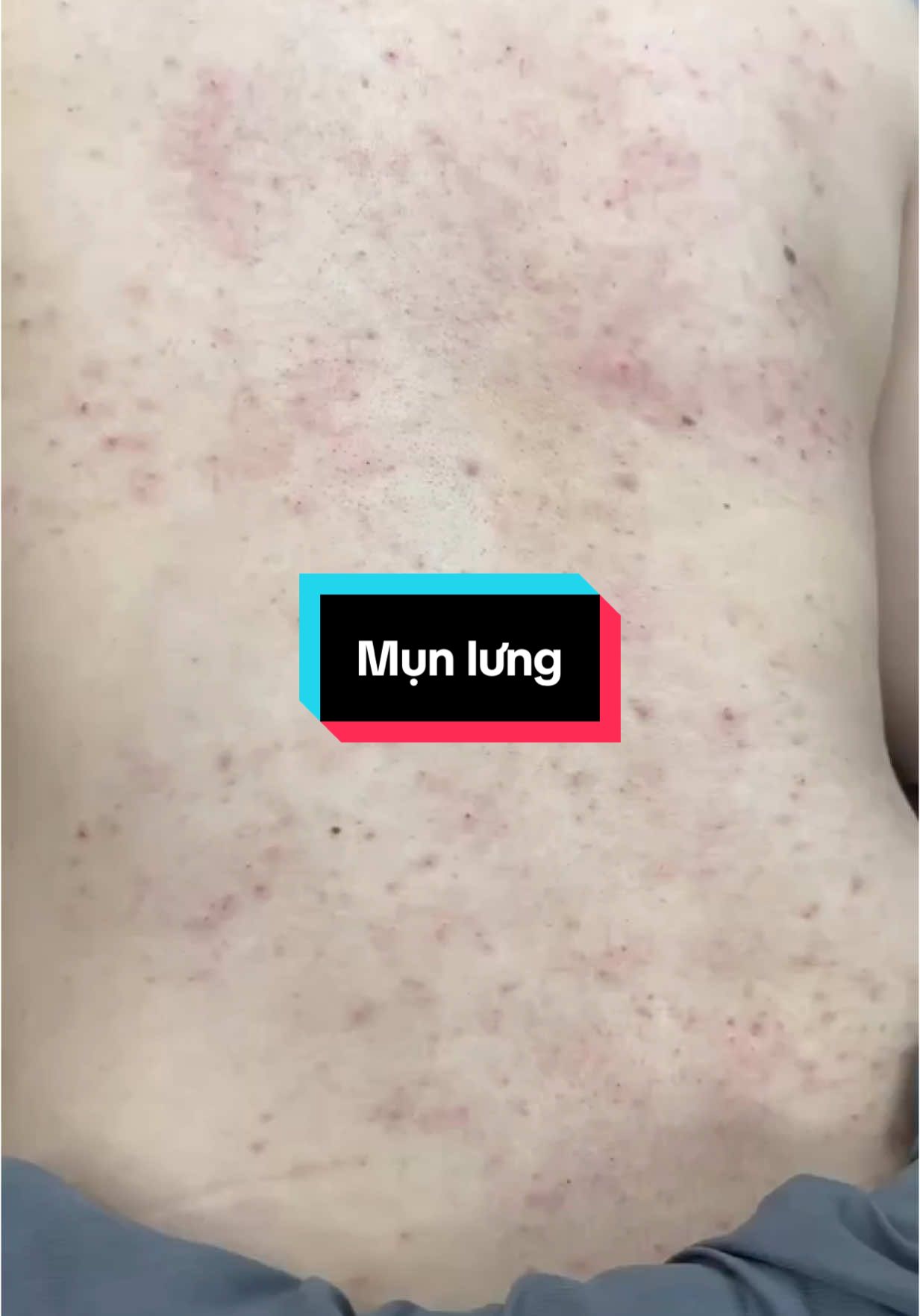 Lưng