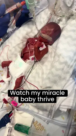 Celebrating 2 months of Wells 💙 #nicubaby #nicumom #nicu #nicustrong #warriorwells 