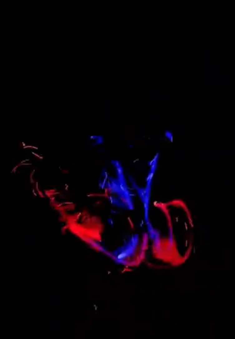 “ARGGGG“ #whiplights #gvlights 