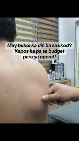 Best pa din magpatingin muna sa doctor. Samahan mo ng pamahid na bitoon oil para makatulong #bitoon #bitoonherbaloil #naturesmiracle #bukol #bitoonoil 