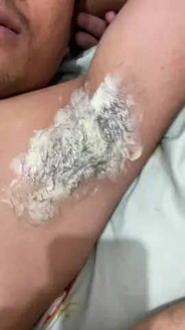 #saludenthairremovalcream order na