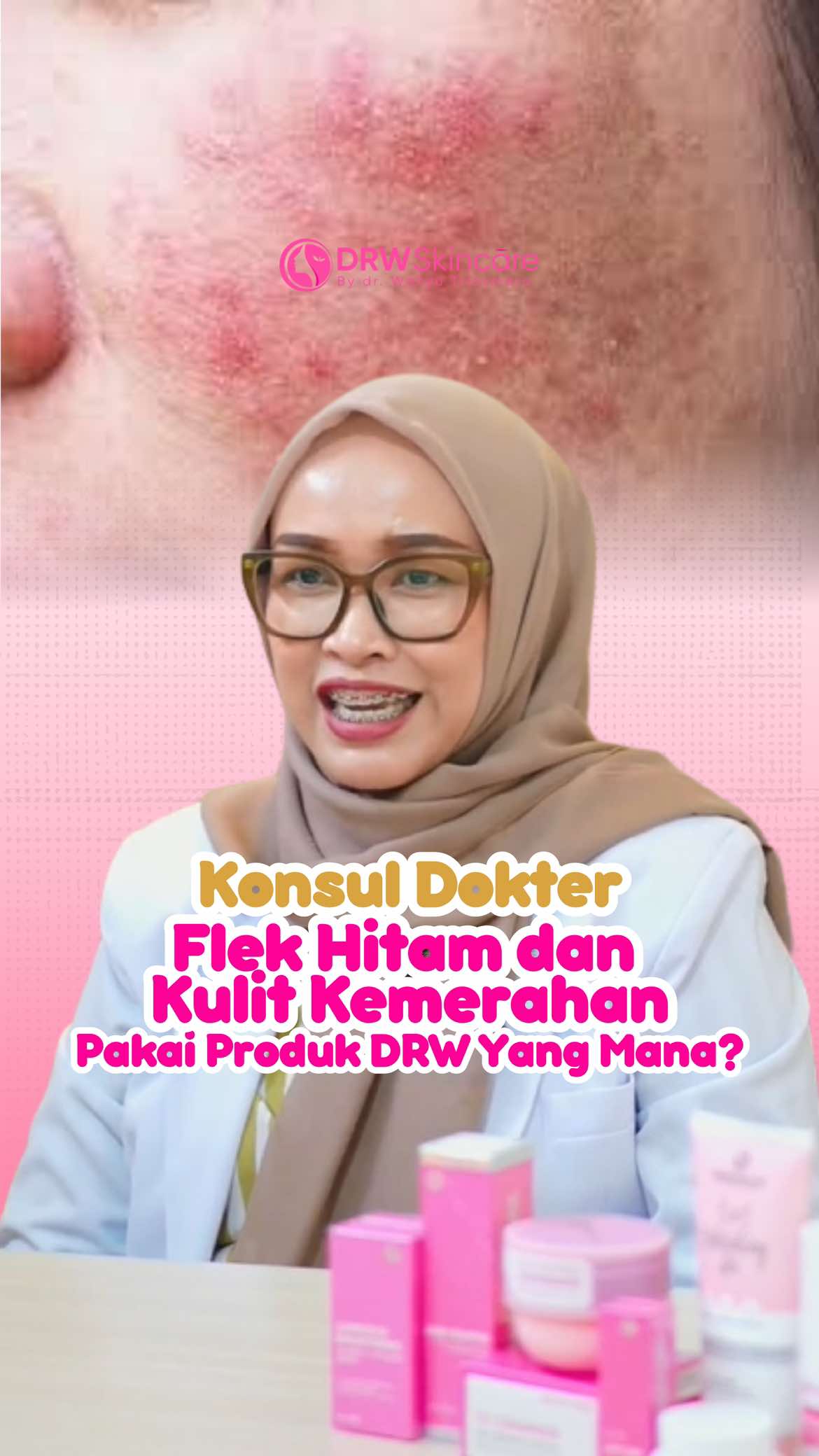 Punya flek hitam tapi kulit kemerahan? Sudah menerapkan tips yang satu ini belum? Kalau belum, ayo lakukan trik yang satu ini agar kemerahan di wajahmu berkurang! #edukasi #flekhitam #kemerahan #moisturizer#drwskincare #1dekadedrwskincare #fypツ