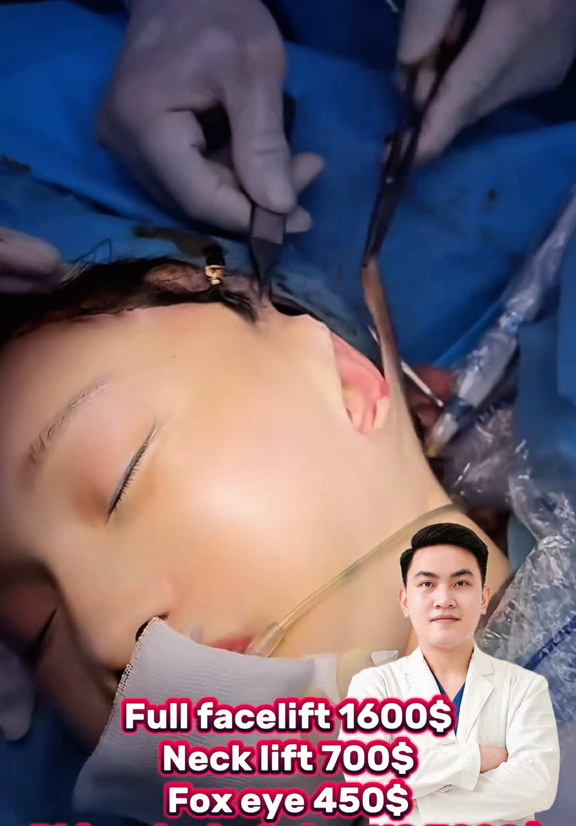 how young will you look after a deep plane facelift and neck lift? #comesticsurgery #facelift #fullfacelift #necklift ##foxeye #rhinoplasty #facelifting #deepfacelift #fyp #kualalumpurmalaysia #kualalumpur #tiktokmalaysia #malaysia #drwonyang 