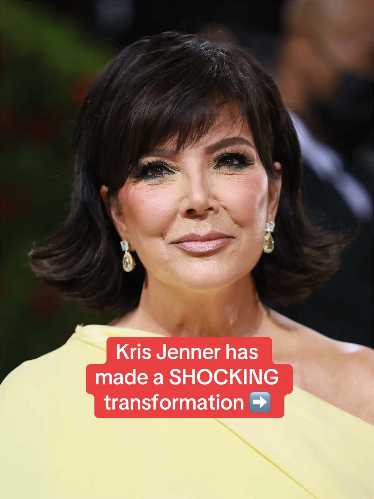 Kris Jenner's strikingly youthful appearance in recent weeks has sparked speculation about whether she's had another facelift. The reality TV star's representative confirmed that she's sought the expertise of Dr. Steven M. Levine - known as the 'facelift maestro' - to help her achieve her fresh-faced look, according to Page Six. Though Kris has not specified what work she's had done with Dr. Levine, his price for a face procedures can run $45,000 and up. The Kardashians star, who was in Paris to support daughter Kim Kardashian as she testified about being the victim of a brutal armed robbery, looked remarkably like her second-oldest daughter in the new pics. 'I thought that was Kim posing as Kris at first… for the first photo,' claimed one amazed fan. 'Thought that was Kim! She looks INCREDIBLE' exclaimed another. Read more at DailyMail.com  #krisjenner #kimkardashian #face #work #surgery #young #kardashian 