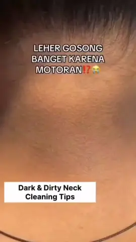 #tips #consejos #mascarillas #aclara #pielbonita #pielperfecta #manchas #SabiasQue #blancamiento 