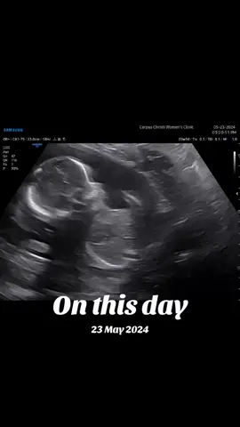 #onthisday