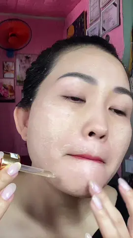 Bôi trét moi hêt nám tàn nhang  ##yodyphuonganh #peelda  ##videoviral  #xuhuong 