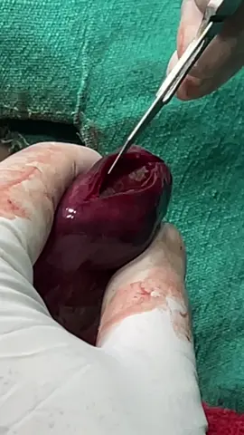 A Golden Retriever presented with signs of gastrointestinal discomfort, and diagnostic imaging revealed a large stone lodged in the intestines. Surgical intervention was performed to successfully remove the foreign body. The patient has made a full recovery and is now healthy and active.