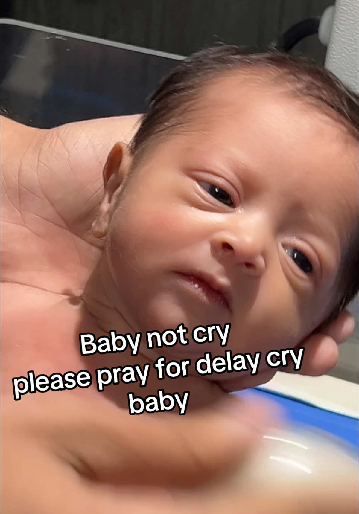 baby not cry please pray for baby #please #pray #s#delay #cry #viral #tiltok #newborn #nicubaby #trending