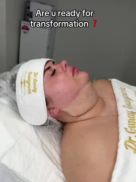 40M views on Instagram😍🫶🏻 #fyp #trend #surgery #trends #doublechinliposuction #plasticsurgery #keşfet #foryoupage #transformation #trending #fypシ 