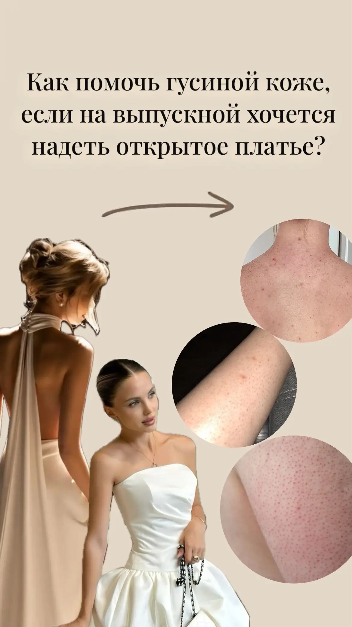 #гусинаякожа #кератоз #энзимнаяпудра #кремсмочевиной #алоегель #гельскислотами #гельдлядуша #geltek #theu #roundlab #7days #aravia #farmstay #artfact #экзамены #егэ #выпускной #платье #платьенавыпускной ❤️