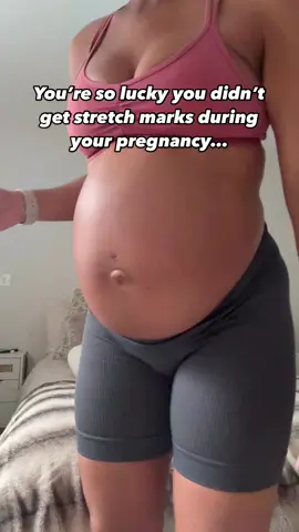 Pregnancy glow? Yes please. Stretch marks? Not so much. 💫 While they’re totally normal and nothing to be ashamed of (your body is doing something incredible!), here are a few ways to support your skin and reduce the chance of stretch marks: ✨ Hydrate like it’s your job – inside and out. Drink up and moisturize daily with nourishing oils or butters (think shea, coconut, or vitamin E). 🍓 Fuel your skin – collagen-rich foods, healthy fats, and plenty of vitamin C support elasticity. 🏋️‍♀️ Gentle movement matters – regular barre, Pilates or walking can support circulation and reduce rapid weight gain. 🛁 Dry brushing + warm showers – increase blood flow and promote cell renewal. 💤 Listen to your body – slow down, rest, and love on yourself every step of the way. Remember: stretch marks or not, you are MAGIC. 🌙 #pregnant #pregnantlife #pregnant🤰 