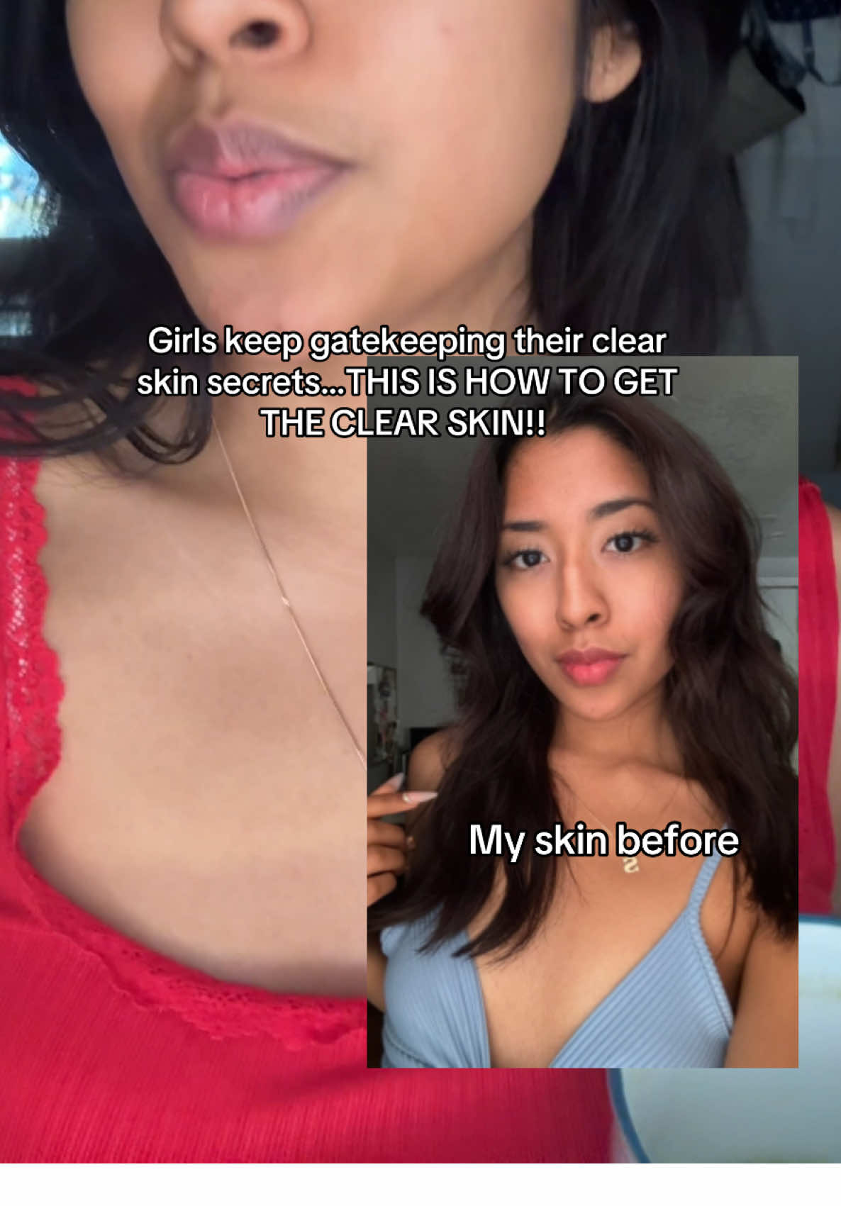 Pretty girls don’t gatekeep! This is how you’re going to achieve the clear skin. I’ve done it for several years and I have always received compliments on how flawless my skin looks!  I unfortunately stopped drinking my celery juice and I broke out, but I’m back on it. This is day four!!! 🤭✨ #celeryjuice #ClearSkinSecrets #forthegirls 