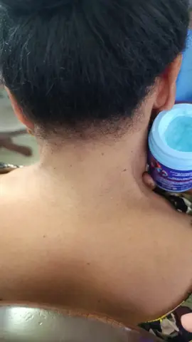 Pain Relief Secret: Activate the Feng Fu Point 🌿✨ Relieve tension and pain throughout your body by stimulating the feng fu point at the base of your neck. Using a blend of VapoRub and fresh lemon juice, this simple technique helps release stress, ease muscle pain, and improve overall well-being. Perfect for relaxation and natural pain relief! 💡💆‍♀️ #PainRelief #NaturalRemedies #StressRelief #DIYHealth #HomeWellness